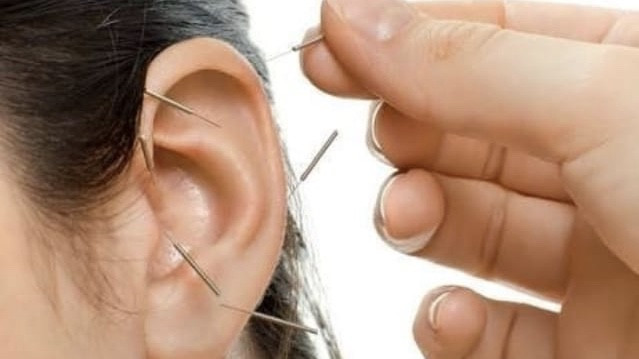 ALFA SPEECH & HEARING ACUPUNCTURE-HIJAMA DORN HEALING