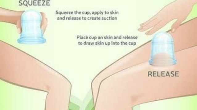 ALFA SPEECH & HEARING ACUPUNCTURE-HIJAMA DORN HEALING