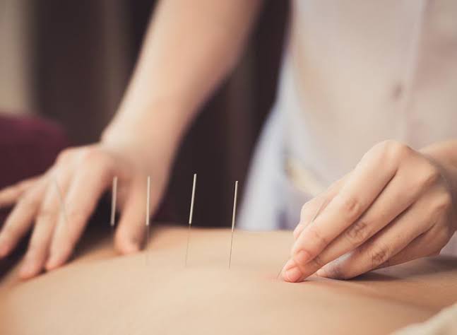 ALFA SPEECH & HEARING ACUPUNCTURE-HIJAMA DORN HEALING